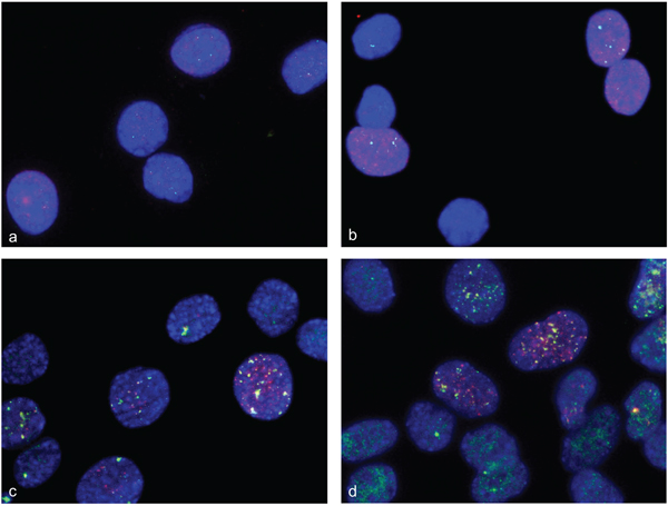 Double strand breaks and DNA repair in differentiation induced C2C12 cells.