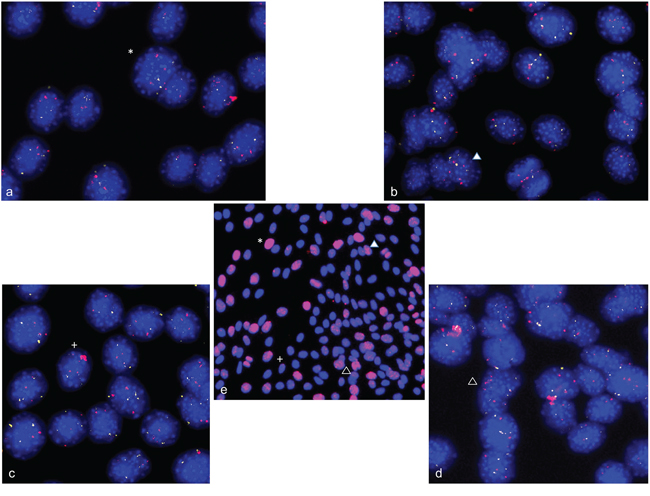 Double strand breaks and gene amplification in differentiation induced C2C12 cells.