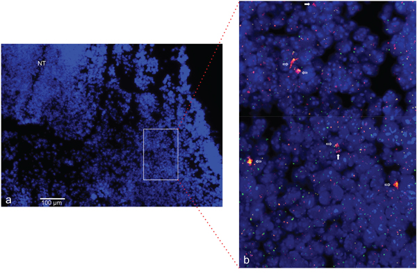 CDK4 and NUP133 amplification in mouse embryo stage E11.5.