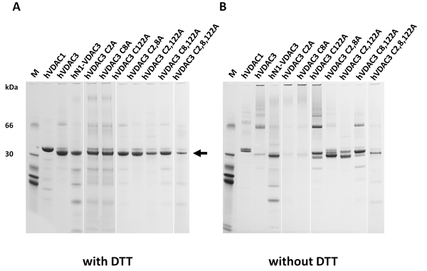 Selective cysteine mutations change the electrophoretic behavior and the ability to complement a porin-defective yeast strain.