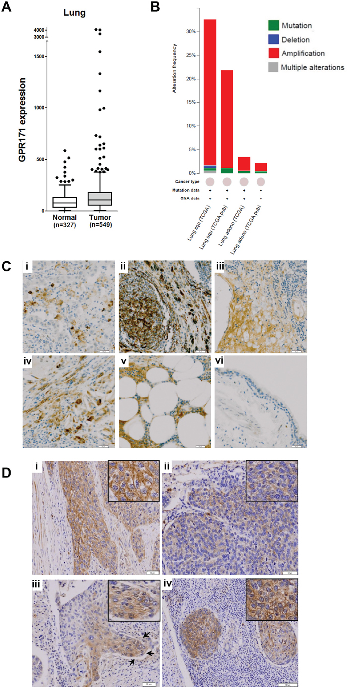 GPR171 expression is induced in lung cancer tissues.