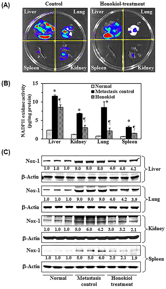 Effect of honokiol on melanoma cells invasion in vivo, NADPH oxidase activity, and the levels of Nox 1 expression in different internal body organs, such as liver, lung, spleen and kidney.