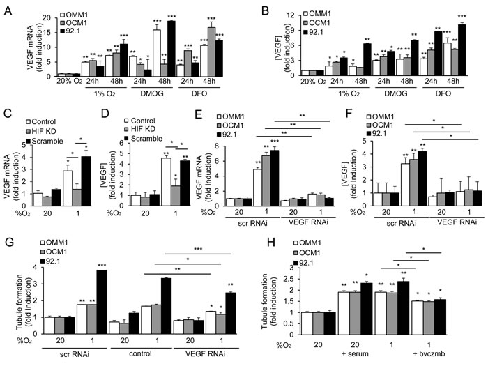 HIF-1&#x3b1;-dependent VEGF expression contributes to the angiogenic potential of UM cells.