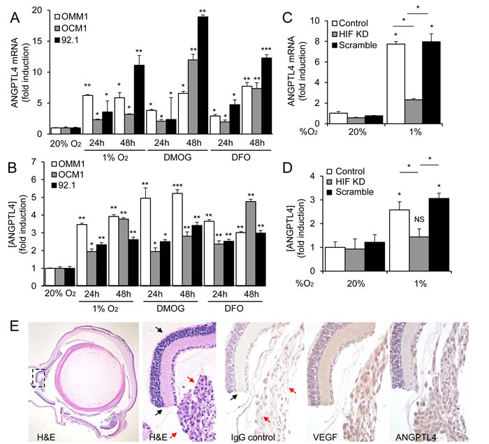 ANGPTL4 is a HIF-1-regulated angiogenic factor expressed by UM cells.