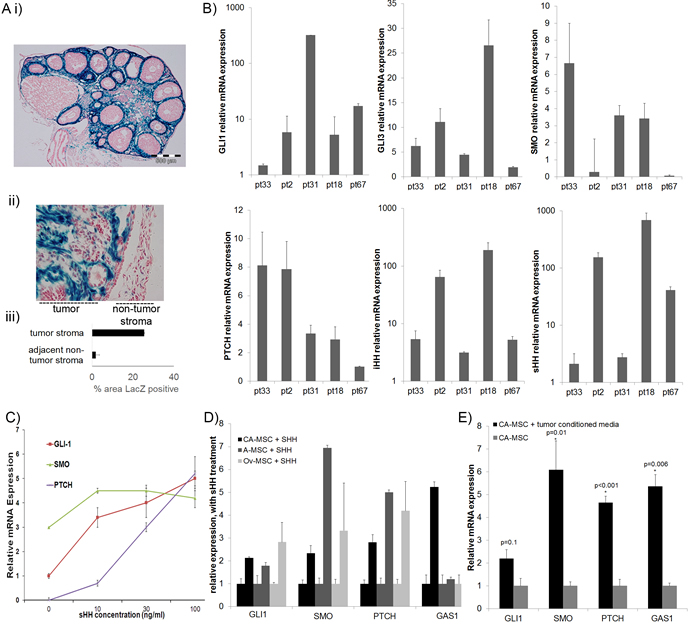 HH signaling is active in the normal ovary, ovarian tumor stroma and in MSCs.