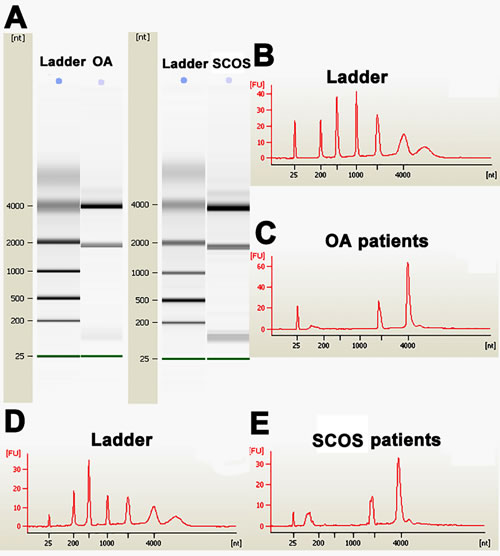 Figure 1 : The quality evaluation of total RNA of human Sertoli cells derived from SCOS patients and OA patients.