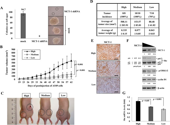 Targeted suppression of MCT-1 attenuates A549 tumor growth.