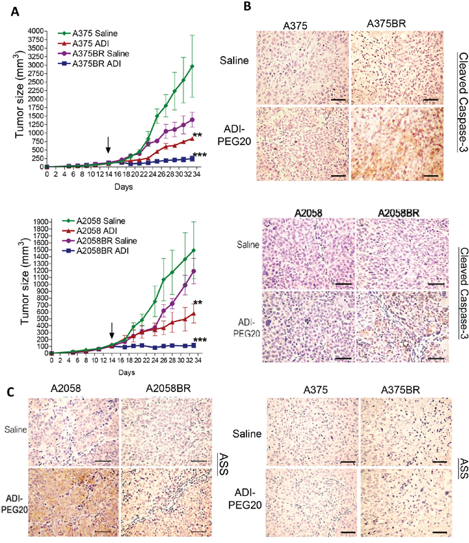ADI-PEG20 aborts BR tumor growth through increased cleavage of caspase-3 and attenuation of ASS1 expression.
