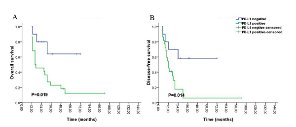 Kaplan-Meier survival analysis of PD-L1 expression and the prognosis including overall survival (A) and disease-free survival (B) for all the patients with glioblastoma (grade IV) during long-time survival or follow up.