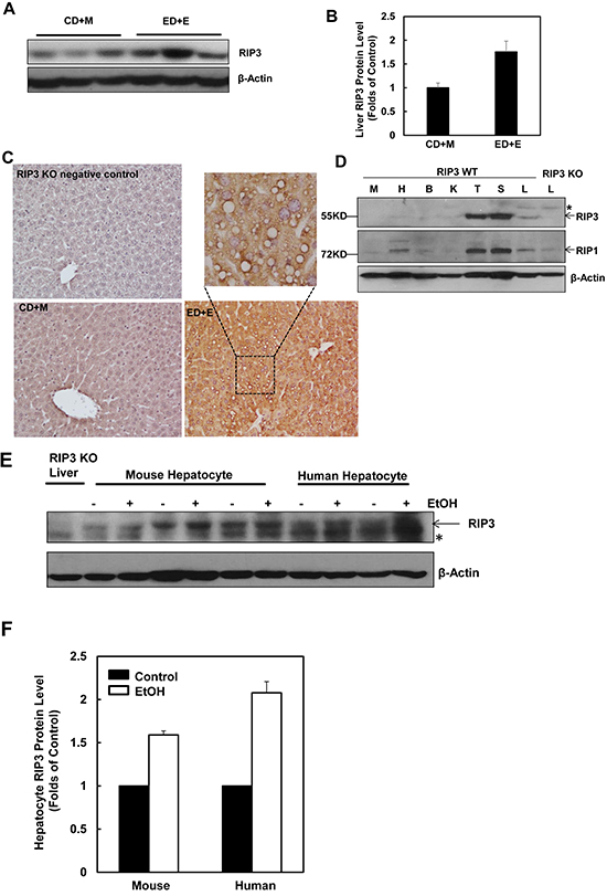Alcohol treatment induces RIP3 expression in mouse liver, primary mouse and human hepatocytes.