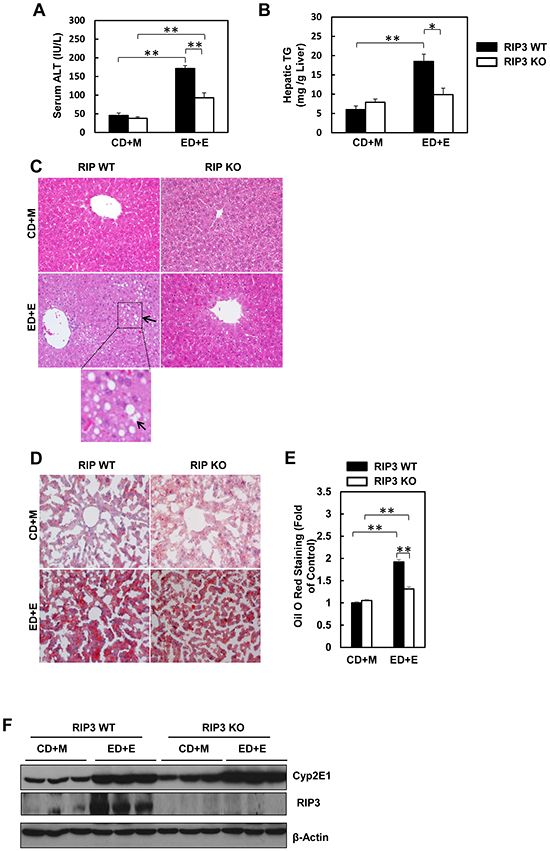 RIP3 KO mice are resistant to Gao-binge alcohol-induced liver injury and steatosis.