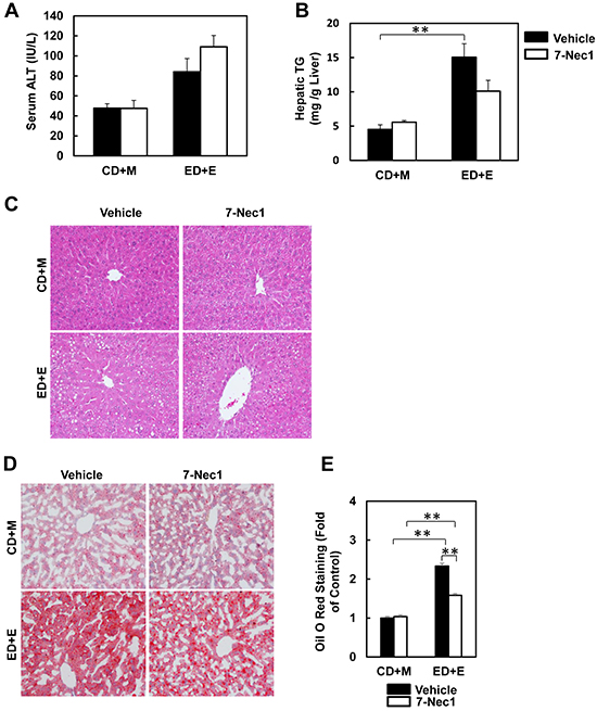 7-Nec1 does not protect against Gao-binge alcohol treatment-induced liver injury and steatosis.