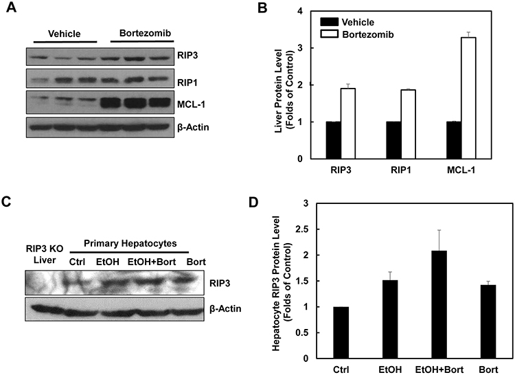 Pharmacological inhibition of proteasome increases protein levels of hepatic RIP1 and RIP3.