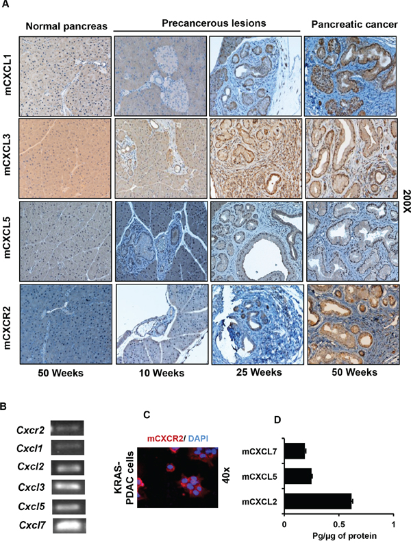 Expression of CXCR2 and its ligands progressively increases in the developing cancerous lesions of Pdx1-cre;LSL-Kras(G12D) mouse model.