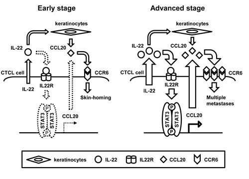 Schematic illustrations of IL-22/STAT3/CCL20 signaling in early and advanced CTCL.