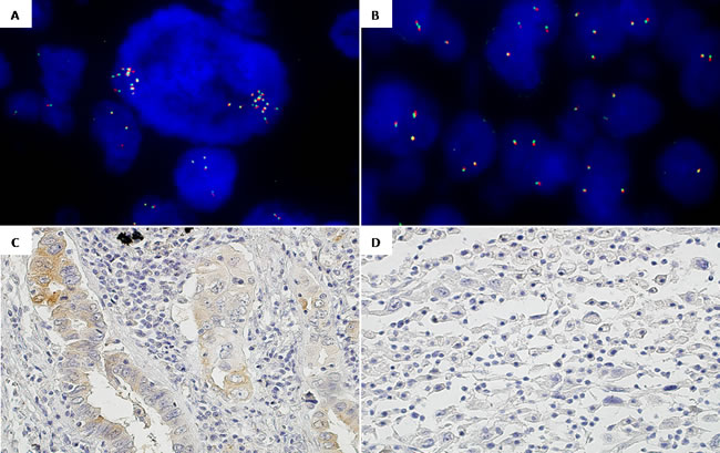 Intra-tumor heterogeneity regarding