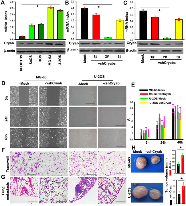 Cryab promoted the invasion and metastasis of OS cells