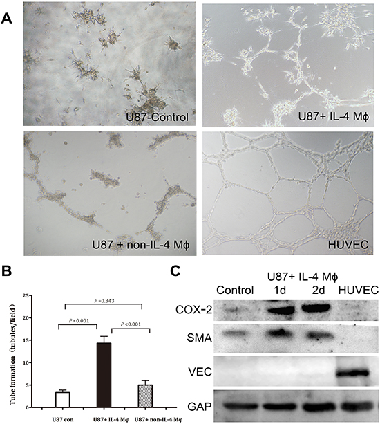 IL-4-activated macrophages induce vascular tube formation in U87.