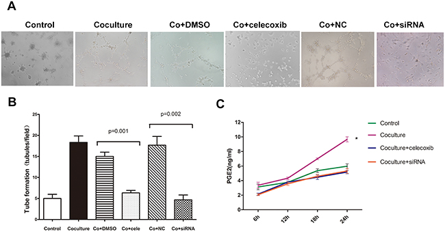 The promotion of VM in U87 cells by M2 macrophages depends on COX-2 high expression.
