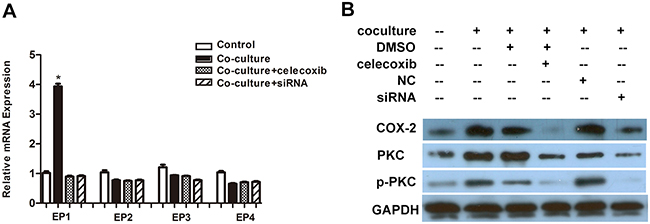 M2 macrophages activate a COX-2/EP1/PKC cascade in U87 cells.