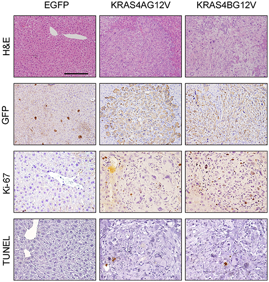 Histological analysis of tumors expressing KRAS4AG12V and KRAS4BG12V.
