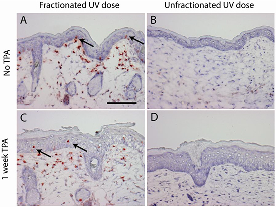 CPD retaining cells are only present after a fractionated sub-sunburn UV dose in epidermis (arrows) and in upper dermis (non-dividing fibroblasts).