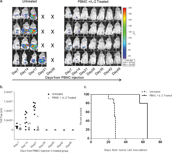 SKOV-3/GFP-Luc tumor bearing mice show complete remission of tumor upon healthy human PBMC and IL-2 treatment.