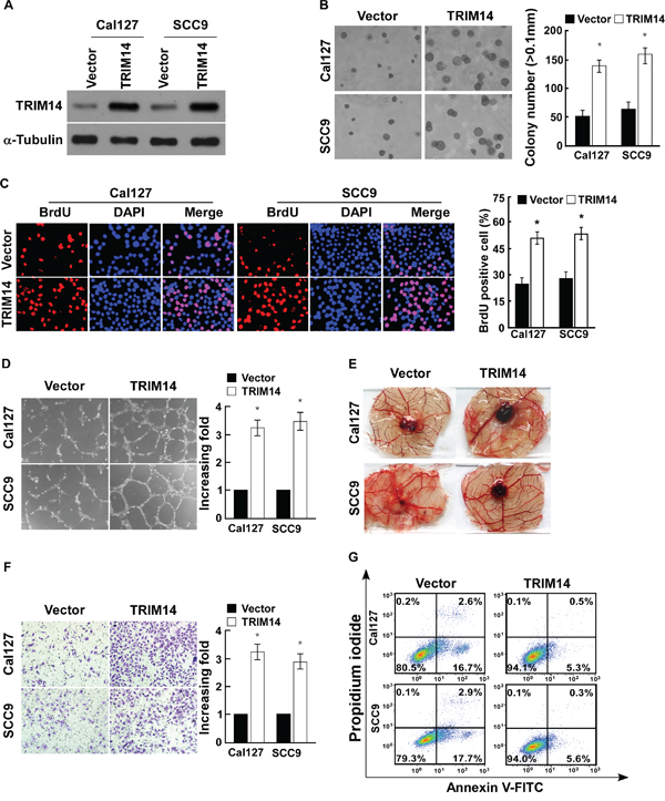 Up-regulation of TRIM14 expression promotes TSCC cell aggressiveness in vitro.