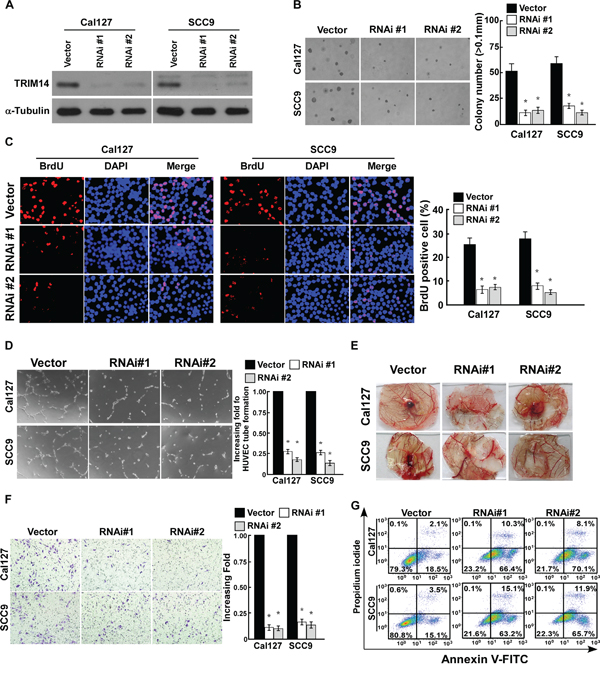 Downregulation of TRIM14 suppresses the aggressiveness of TSCC cells.
