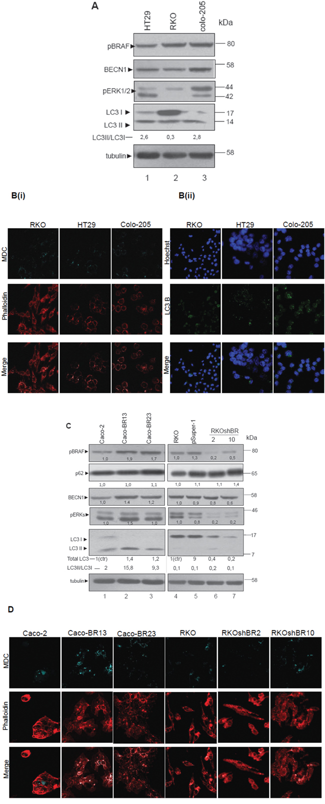 BRAF oncogene induces the expression of LC3- Association of autophagy with mutant BRAFV600E.