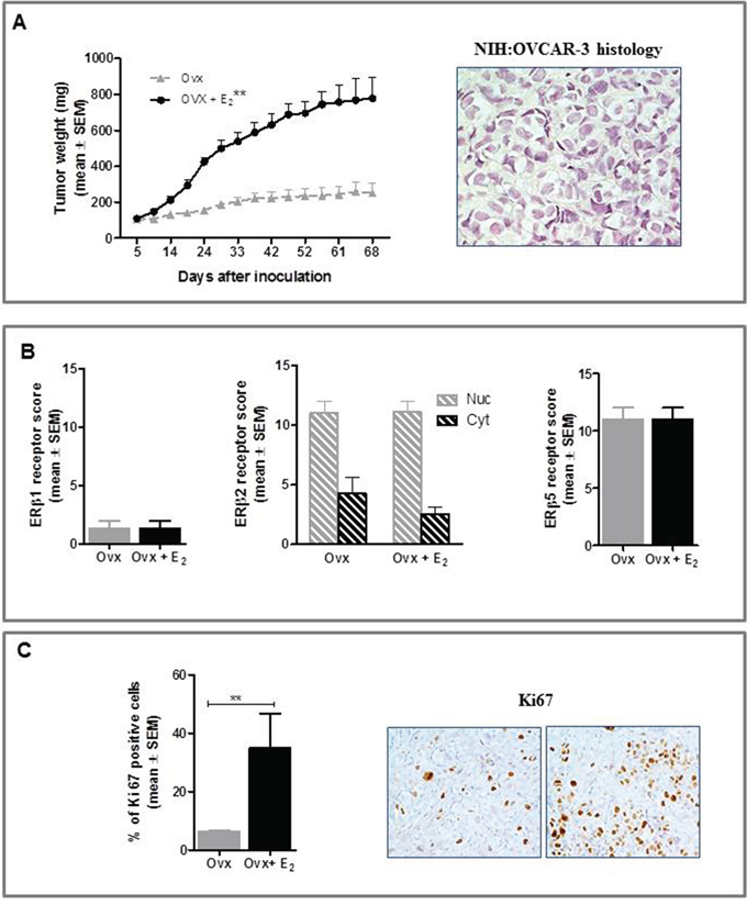 Effect of E2 on in vivo growth of NIH:OVCAR-3 in female BALB/c nude mice.