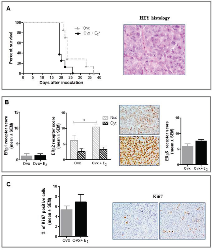 Effect of E2 on in vivo growth of HEY cells in female BALB/c nude mice.