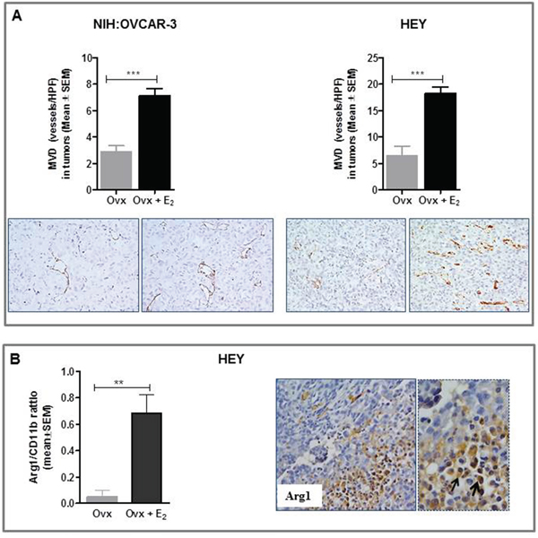 Effect of E2 on tumor angiogenesis and intratumoral TAM densities in in vivo preclinical models of ovarian cancer.