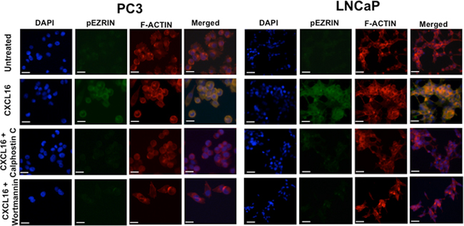 CXCR6-CXCL16 dependent Ezrin phosphorylation in PCa cells.