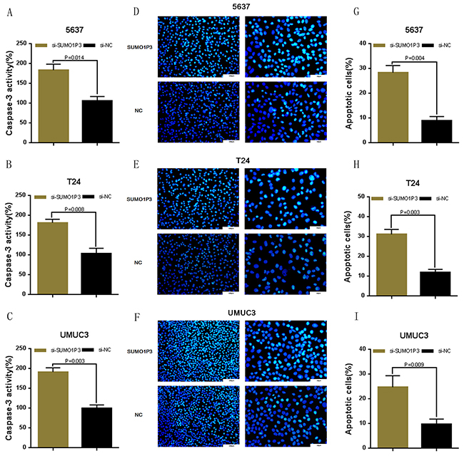 Silencing long noncoding RNA SUMO1P3 induced cell apoptosis in bladder cancer cells.