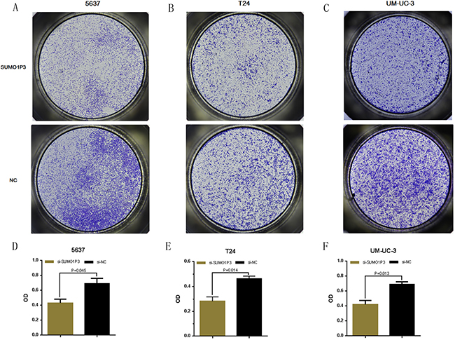 Silencing long noncoding RNA SUMO1P3 inhibited cell migration in bladder cancer cells.