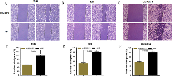 Silencing long noncoding RNA SUMO1P3 inhibited cell migration in bladder cancer cells.
