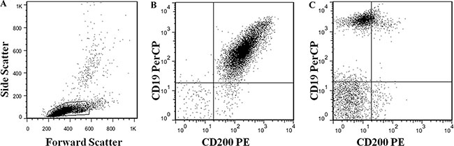 Gating information (A) and representative data plots of CD200 positive (B) and negative (C) cases.