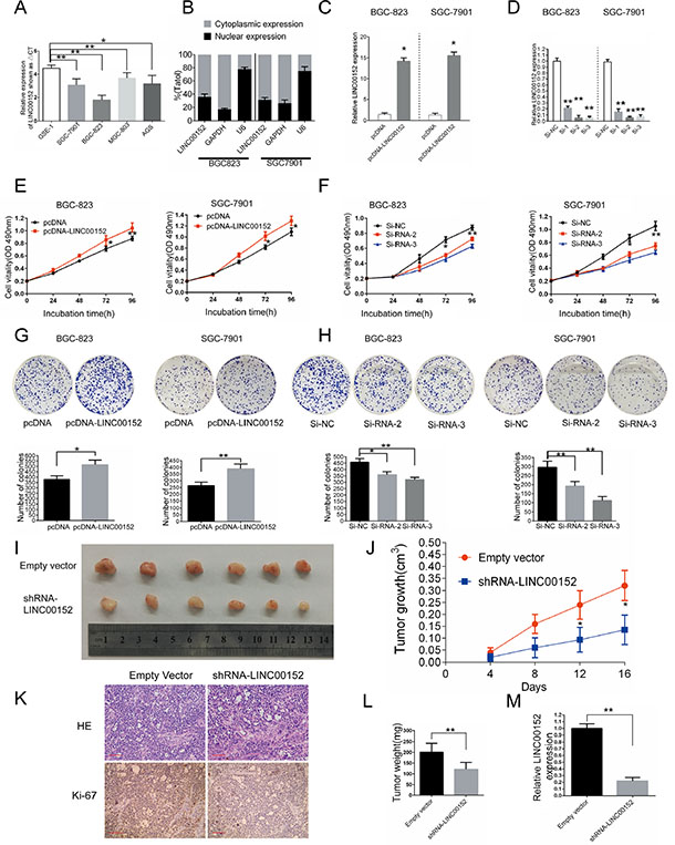 Effects of LINC00152 on gastric cell growth in vitro and in vivo.