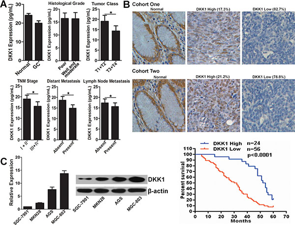 DKK1 expression pattern in GC.