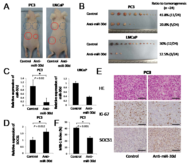 The inhibition of miR-30d suppresses tumor growth in vivo.