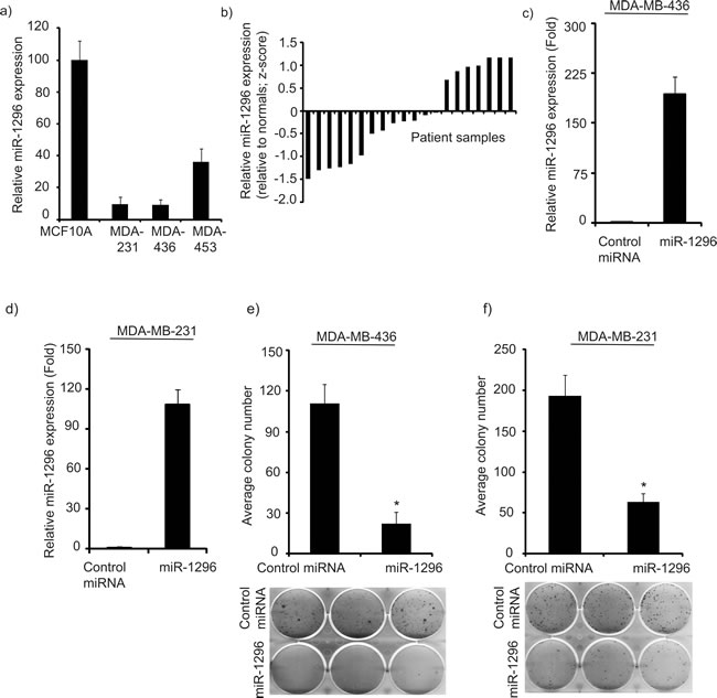 miR-1296 is suppressed in triple negative breast cancer cell lines and tissues.