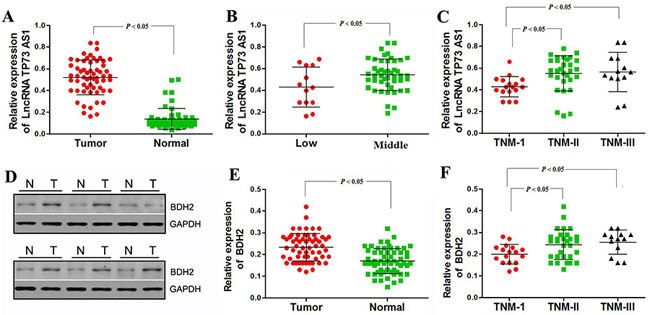 LncRNA TP73-AS1 and BDH2 expression correlate with TNM stage in EC.