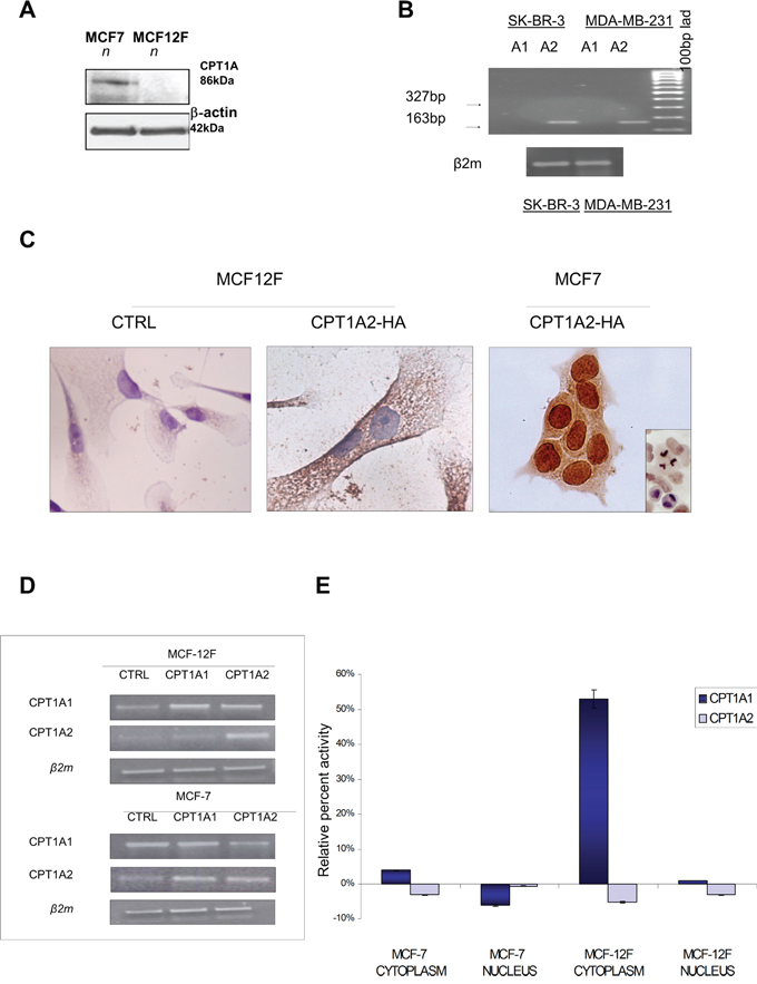 Protein expression, localization and transferase activity of CPT1A in MCF7 breast cancer cells compared to MCF12F control cells.