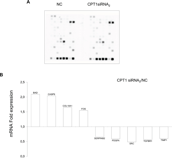 Expression analysis of CPT1Av2 silencing target genes.