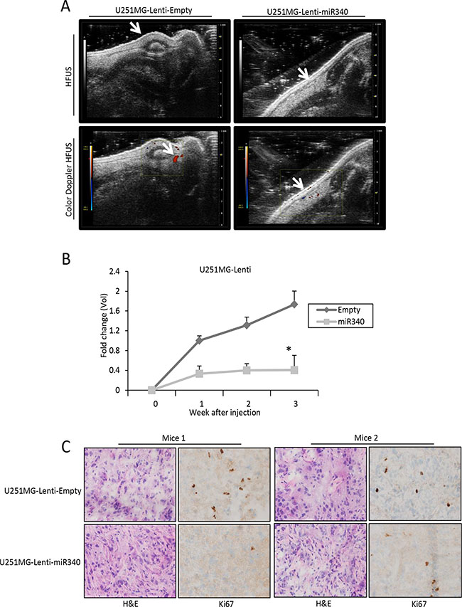 miR-340 inhibits the growth of glioblastoma xenografts in vivo.
