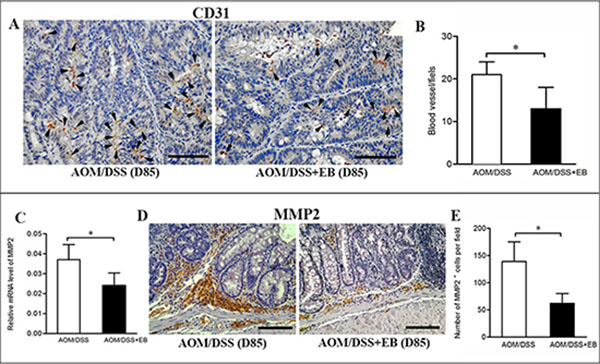 Embelin decreased vascularity and MMP2 expression in late carcinoma stage.