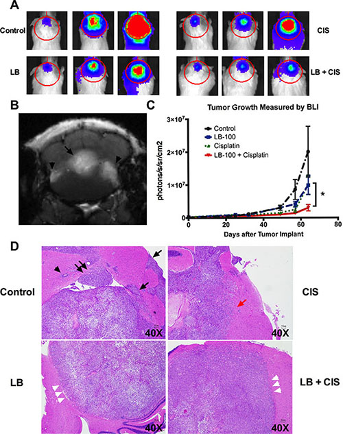 LB100 in combination with cisplatin significantly decreases tumor burden in vivo.