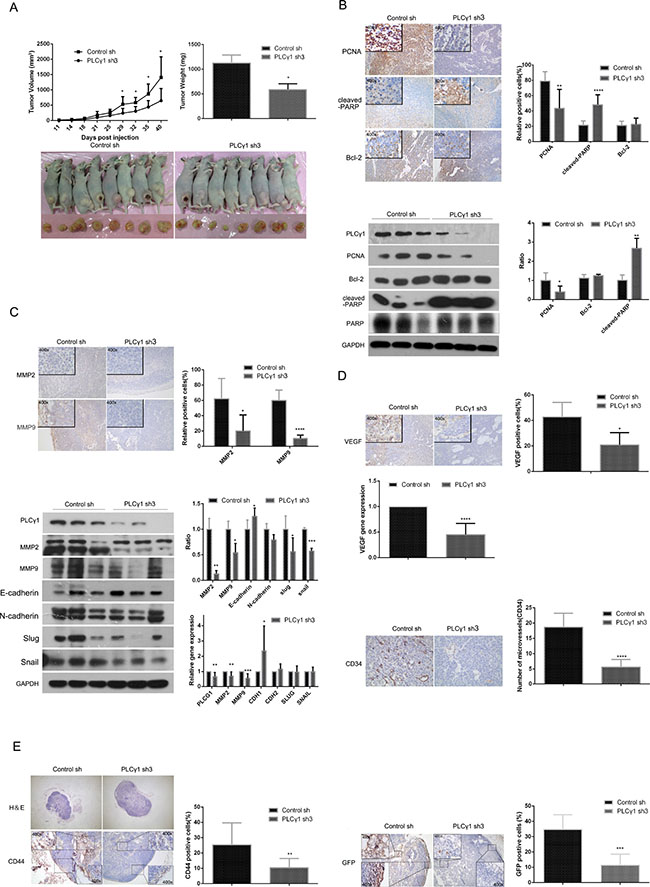 Depletion of PLC&#x03B3;1 suppresses growth and metastasis of gastric adenocarcinoma in a nude mouse tumor xenograft model.