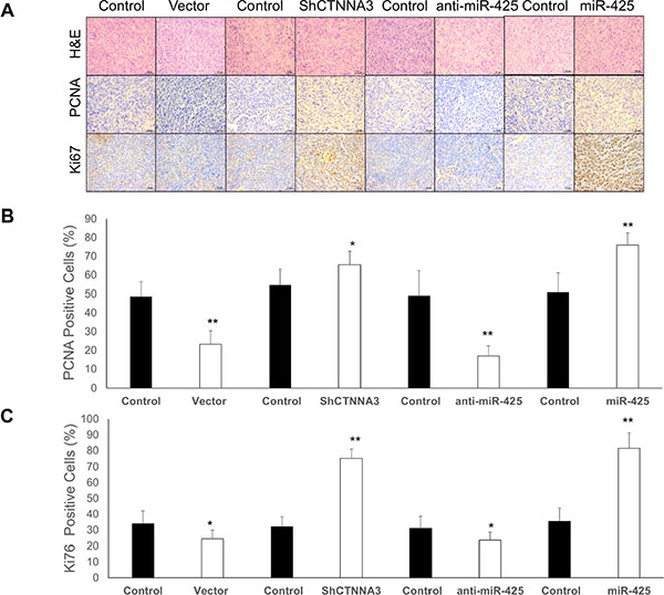 CTNNA3 suppresses the tumor growth of the HCC cell xenograft in nude mice.